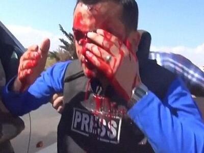 Γαλλία: Περισσότεροι από 90 δημοσιογράφο...