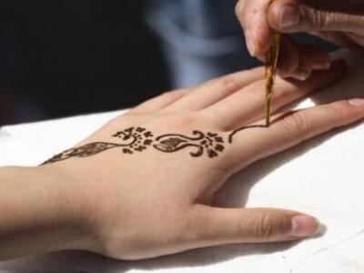 Δείτε τι έπαθε 12χρονη από τατουάζ χένας! ΦΩΤΟ 