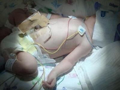 Θαύμα: Μωρό που γεννήθηκε χωρίς αίμα έζησε!