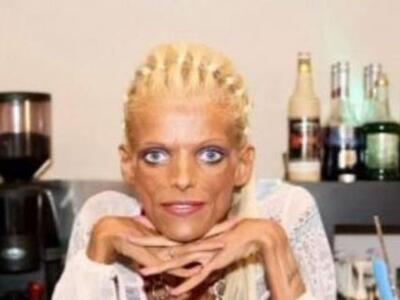 Νανά Καραγιάννη: Το τελευταίο σοβαρό ιατ...