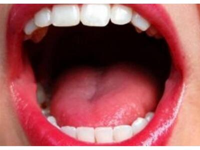 Ραγδαία αύξηση του καρκίνου του στόματος...