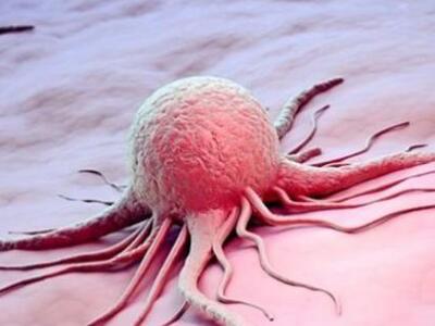 Η «ταξική» διάσταση του καρκίνου