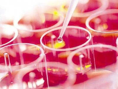 2.000 τεστ για HIV σε πέντε πόλεις της Ε...