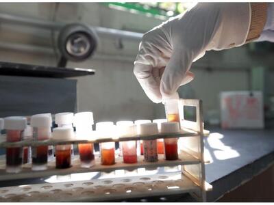 Ελπιδοφόρα θεραπεία αντισωμάτων κατά του AIDS