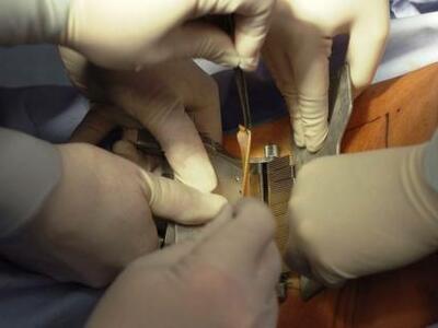 Νεφρός εργαστηρίου από βλαστικά κύτταρα