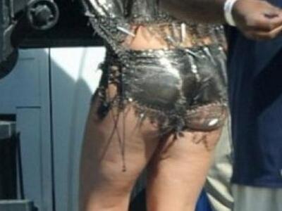 Mήπως με τόση κυτταρίτιδα να μη φορούσες...