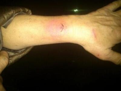 Κινέζες δάγκωσαν Ελληνίδα γιατί... ζήτησ...