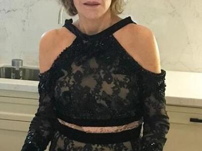 Here’s me the next morning. I couldn’t g...