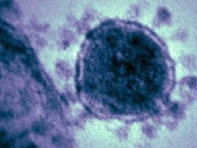 Νέο θύμα του κορονοϊού που μοιάζει με τον SARS