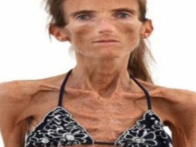 Η Valeria ζυγίζει μόνο 25 κιλά! Η ιστορί...