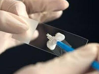 Πάτρα: ΔΕΙΤΕ πώς μπορείτε να κλείσετε ρα...