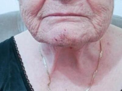 Φρίκη στο Αγρίνιο: Ποντίκια επιτέθηκαν σ...