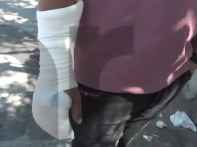 Κορυδαλλός: Διανομέας δάγκωσε και έκοψε ...