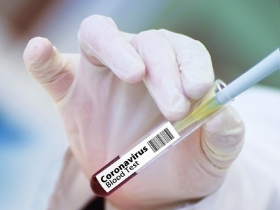 Κορωνοϊός: Καλά νέα για το εμβόλιο της Ο...