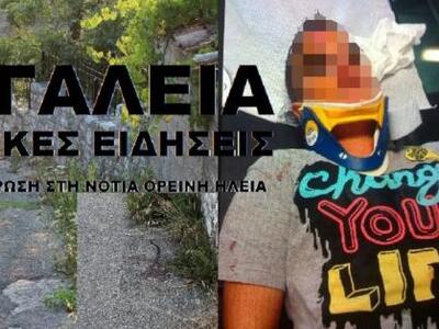 Βγήκε βόλτα με το ποδήλατο και βρέθηκε α...