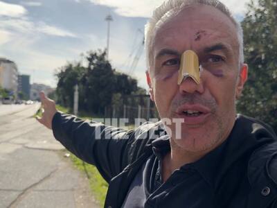 Δείτε πως κατέληξε γνωστός πατρινός που ...