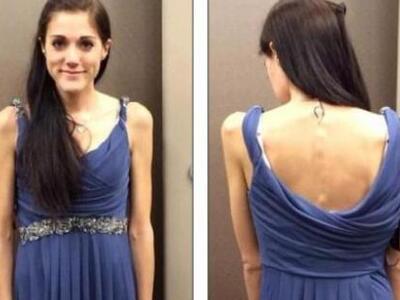 24χρονη έχει να φάει έναν χρόνο - Κινδυν...