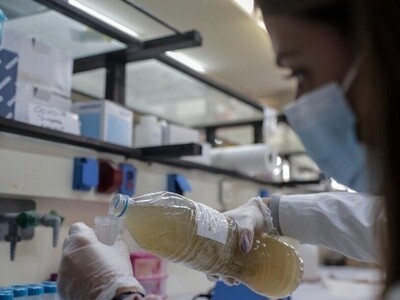 Λύματα: Πτωτική τάση του ιικού φορτίου στην Πάτρα