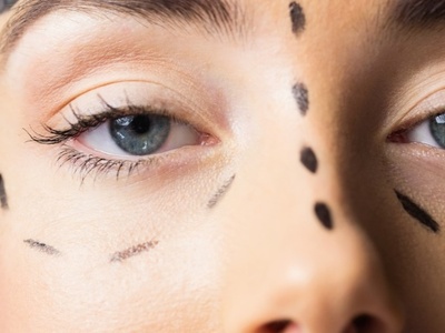 Πλήρωσε €40.183 για θεραπείες αισθητικής...