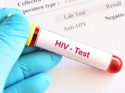 HIV: Οι ΗΠΑ ενέκριναν φάρμακο που θα μπο...