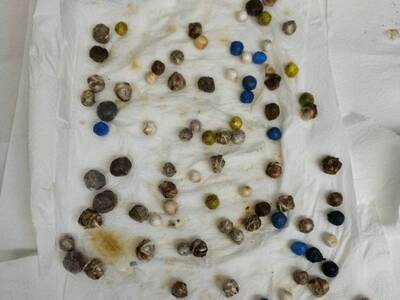 Οι ακτινογραφίες  στο Νοσοκομείο του Ρίο...