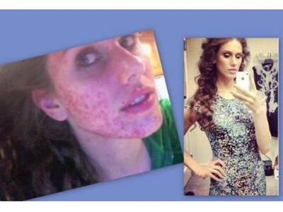 Απίστευτο, η Κασσάνδρα Μπάνξον είχε παλι...