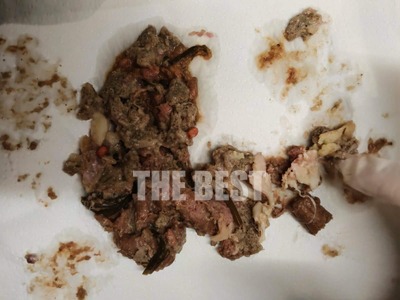 Πάτρα: Ποντικοφάρμακο και γυαλιά σε κιμά...