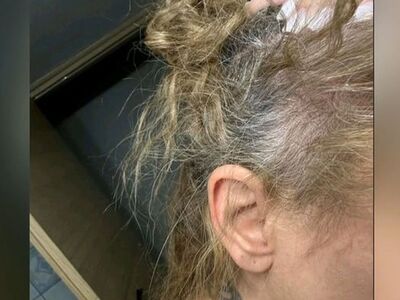 Σε σοκ η 43χρονη- θύμα ξυλοδαρμού από επ...