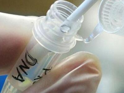 ΕΦΕΤ: Επτά δείγματα τροφίμων βρέθηκαν θε...