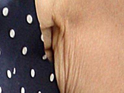 Κι όμως! Αυτό το ζαρωμένο... δέρμα ανήκε...