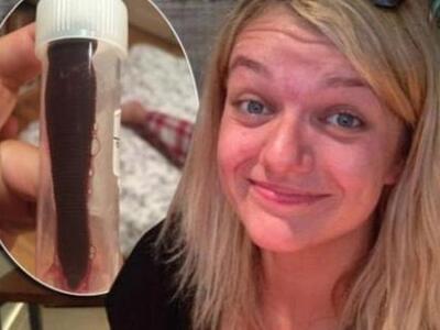 ΑΠΙΣΤΕΥΤΟ: Βδέλλα μήκους 7,5 εκατοστών ζ...