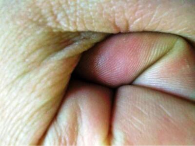 Νομάρχης  ρίχνει ...μπουνιά σε δημοσιογράφο 