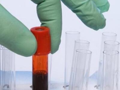 Βρετανία: Εξέταση αίματος θα προβλέπει τ...