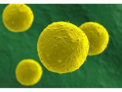 Ο καρκίνος είναι θέμα.. ατυχίας κυτταρικ...