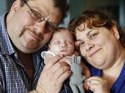 Αυστραλία: Μωράκι γεννήθηκε 395 γραμμάρι...