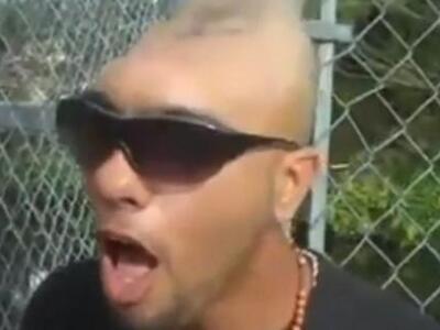 Απίστευτο...Ο άνθρωπος με το μισό κεφάλι...