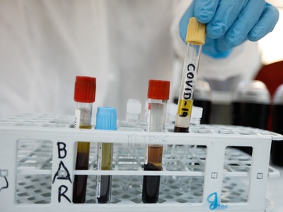 Κορωνοϊός: «Καθόλου απίθανο το ενδεχόμεν...