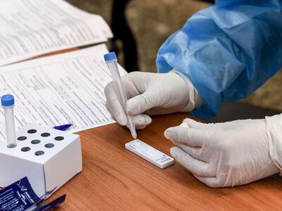 Δωρεάν rapid test σε Αχαΐα και Ηλεία από...