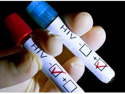"Μεταλλαγμένη" θεραπεία για το AIDS