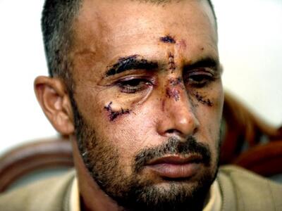 Ένα από τα δυο θύματα της επίθεσης