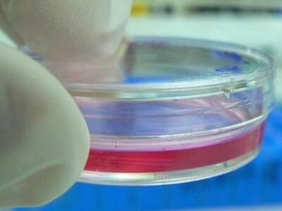 Πιο κοντά στο γενετικό διαγνωστικό τεστ ...