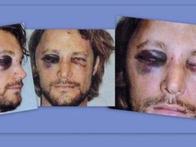 ΣΟΚ! Τον «έσπασε στο ξύλο» ο Olivier Mar...