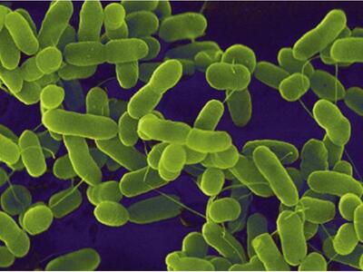 Ε.coli: Σε προληπτική ανάκληση προϊόντος...