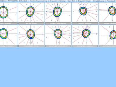 Ενεργειακό αποτύπωμα ακροδαχτύλων