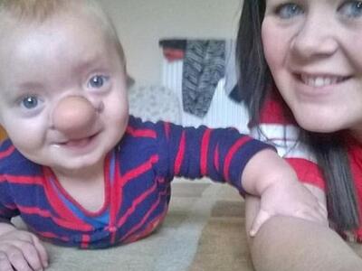 Ο εγκέφαλος αναπτύχθηκε μέσα στη μύτη του