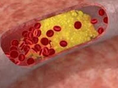 Πολλά υποσχόμενα πειραματικά φάρμακα για...