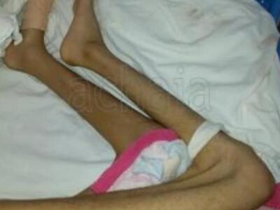 Πάτρα: Κινητοποίηση απο το Υπουργείο Υγε...