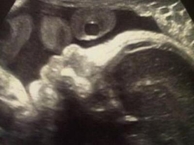 Η πρώτη φωτογραφία του μωρού τους! ΔΕΙΤΕ...