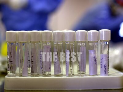 Πέτσας:  Τα τεστ έχουν ξεπεράσει τις 226.000 