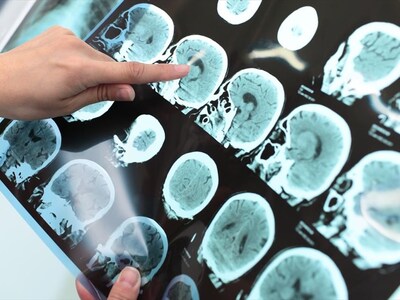 Πανευρωπαϊκή μελέτη για εξέταση ακριβεία...